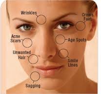 Peels: Skin rejuvenation